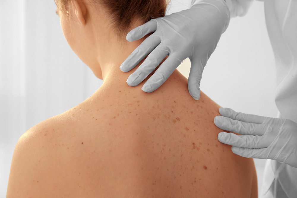 Dermatology
