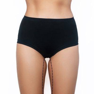 Inner thigh fat removal treatment