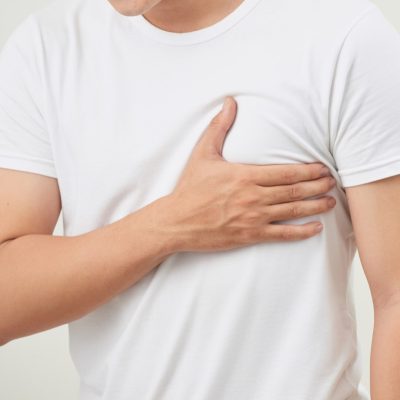 males breast condition - marlow body cosmetic treatments