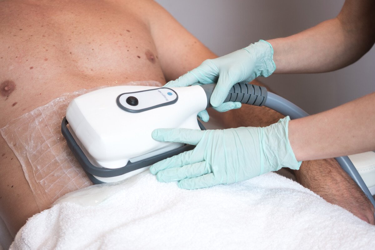 FAT FREEZING: COOLTECH® DEFINE